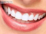 Cosmetic Dentistry Treatment in Hyderabad