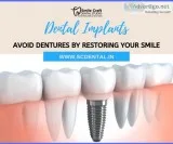 Benefits of Dental Implants - scdental