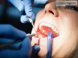 Low cost dental impalnts in bhopal