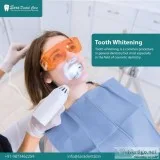 Why should you get your Teeth Whitening Treatment