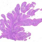 Interested in the Best Oral histology services in Delhi NCR Indi