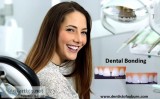 Dental Bonding  affordable cosmetic dentistry Auburn  dental imp