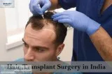 Hair Transplantation Cost in India