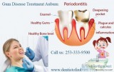Gum Disease Treatment Auburn  Dental implants Near Me WA