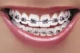 Dental Implants Treatment Mulund