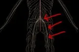 Get The Best Sciatica Pain Relief MD And Live Your Life Without 