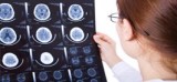 Neurology Doctors in Brooklyn NY  Total Neuro Care P.C.
