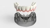Auburn Dentist  Androscoggin Dental Group