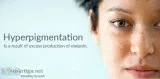 Best ointment for hyperpigmentation