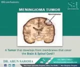 How to Find Brain Tumor Treatment Center Near Me