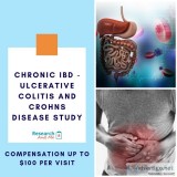 Chronic IBD - Ulcerative C. and Crohns Disease &mdash Up to 100.