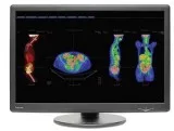 Refurbished 4MP Colored Radiology Monitor  NDS Dome GX4MP