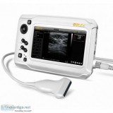 SonoMaxx MX300 Compact Touch Ultrasound