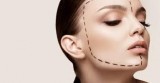 Dermal Filler Injections