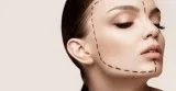 Dermal Filler Injections
