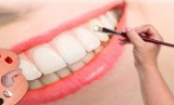 Dentist in Bryan  Teeth whitening in college station