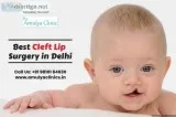 Cleft Lip Surgery For a Beautiful Smile