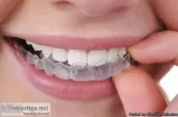 Cost of Getting Braces in Delhi