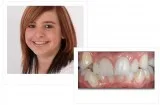 Best Cosmetic and Family Dentist in Waterloo