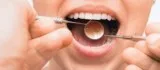 Make Your Smile More Beautiful Using Advanced Treatments In Beth