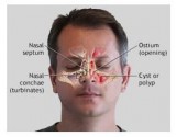 Best Sinus Doctor and Surgeon in Los Angeles  Calwestent.com