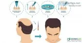 Best Dermatology and Hair Transplant surgeon in  New Delhi