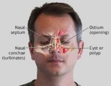 Best Sinus Doctor and Surgeon in Los Angeles  Calwestent.com