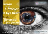 Thyroid Eye Disease Is Not As Simple As It Seems