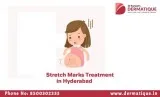 Stretch Markers Treatment In Hyderabad