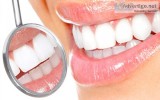 Dental Treatments - Mylai Dental  Dental Clinic in Mylapore