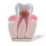 Affordable General and Cosmetic Dentist in Windsor  Best Dental 