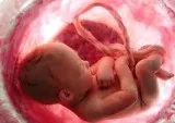 Infertility Center in Hyderabad