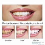 Teeth Whitening in Gurgaon- Dr. Khullar s Dental Clinic