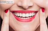 Smile makeover in Gurgaon  Dr Bhatia s Dental Clinic