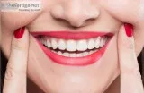 Smile makeover in Gurgaon  Dr Bhatia s Dental Clinic