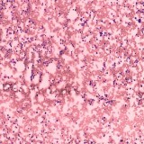 Want the Best Histology slides services in Delhi NCR India