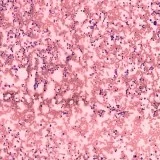 Want the Best Histology slides services in Delhi NCR India