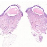 Looking for Best Dermatopathology slides services in India or gl