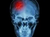 Dr. Ranga Chelva Krishna  Strokeclinicsofnyc.c om