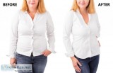 Weight Loss Centre in Delhi-Dr Anjana Kalia