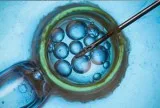IVM Treatment in Hyderabad