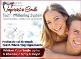 Impressive Bright White Smile Pro Teeth Whitening System