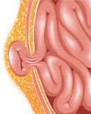Cure Hernia With The Best Hernia Surgery Clinic In Kolkata