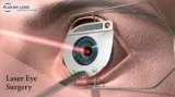 Best contoura vision surgery in Delhi NCR.