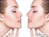 Nose surgery cost in Hyderabad