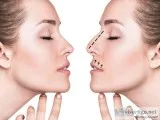 Nose surgery cost in Hyderabad