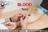 Best blood testing lab