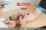 Best blood testing lab
