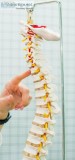 Best Chiropractors in Coral Springs FL