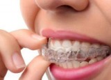 Invisalign Frisco TX
